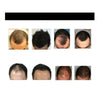 EastMoon™ | No more bald spots!